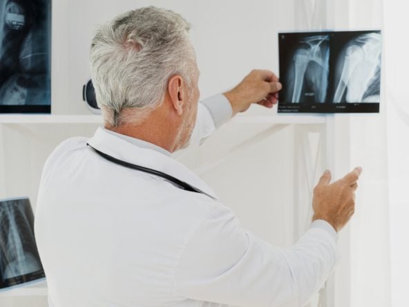 Importancia de la Prevención de la Osteoporosis en Residencias de Mayores