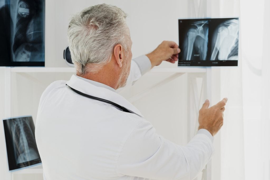 Importancia de la Prevención de la Osteoporosis en Residencias de Mayores